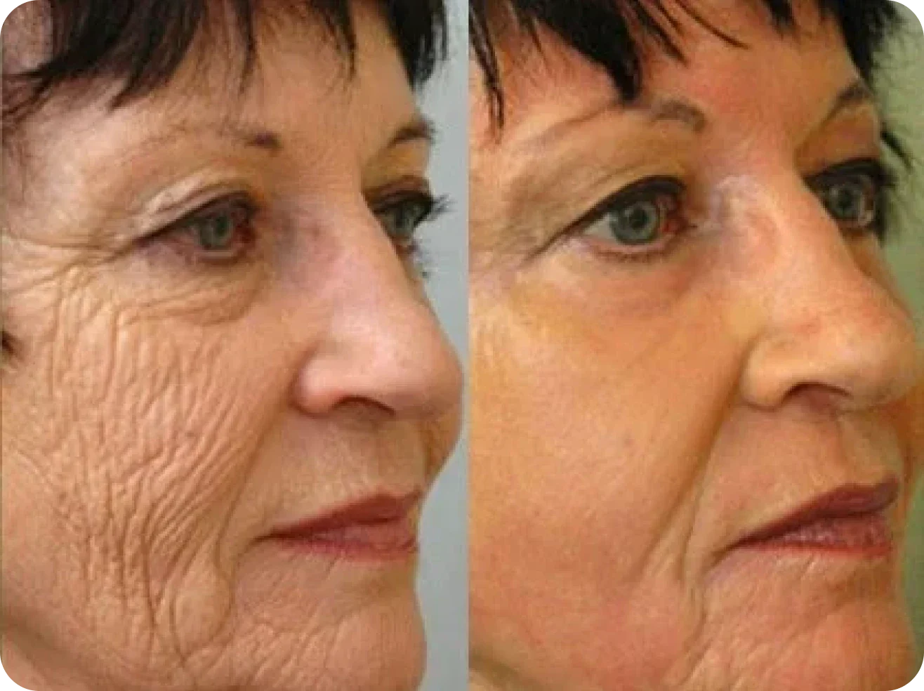 Olavita Botox Serum Review