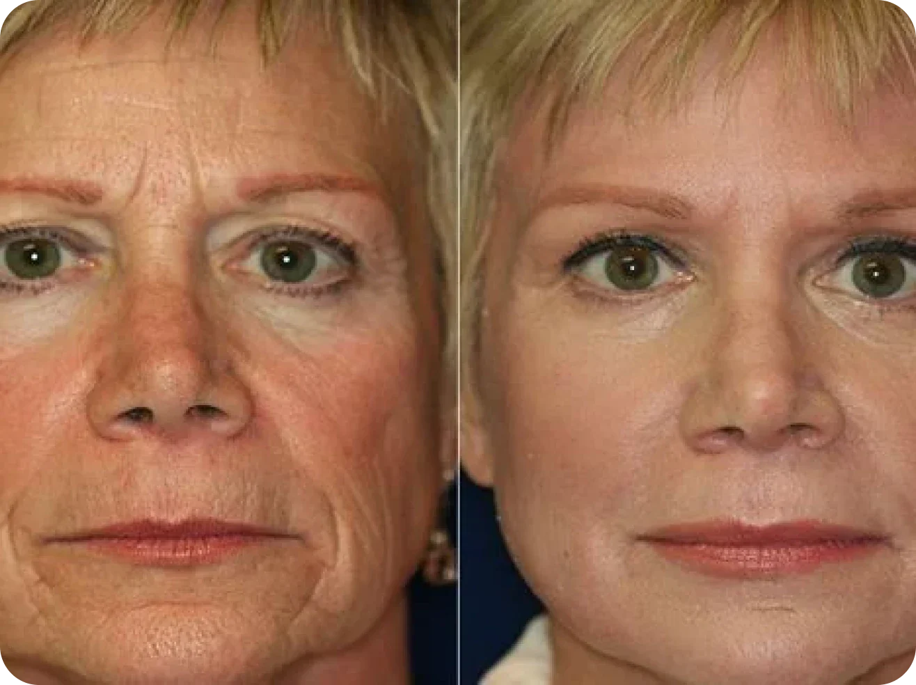 Olavita Botox Serum Reviews